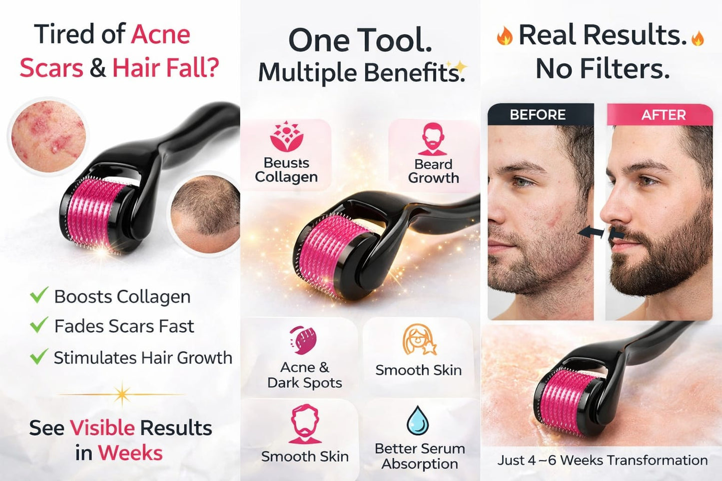 ✨ 540 Needle Derma Roller – Skin Glow & Hair Growth Tool 💆‍♂️Titanium needles use⬆️🧑