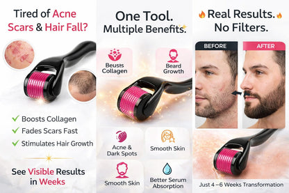 ✨ 540 Needle Derma Roller – Skin Glow & Hair Growth Tool 💆‍♂️Titanium needles use⬆️🧑