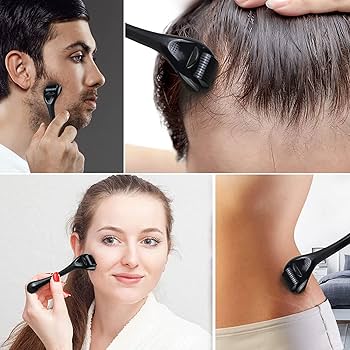 ✨ 540 Needle Derma Roller – Skin Glow & Hair Growth Tool 💆‍♂️Titanium needles use⬆️🧑
